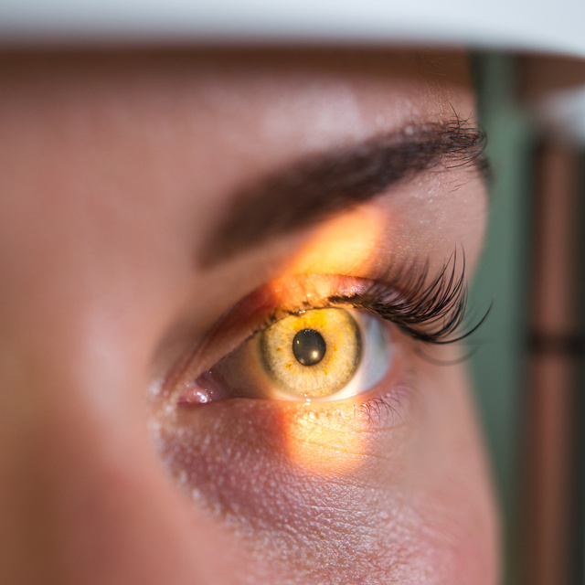 Vision Therapy in Mesa
